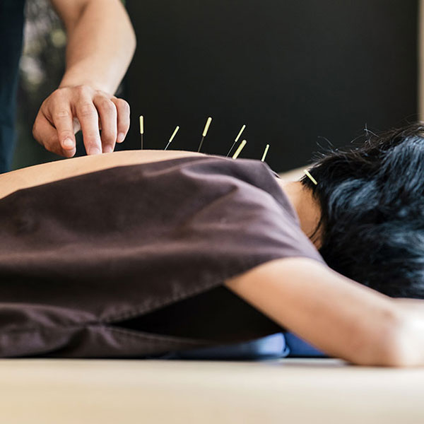 Acupuncture for pain management in Fresno, CA