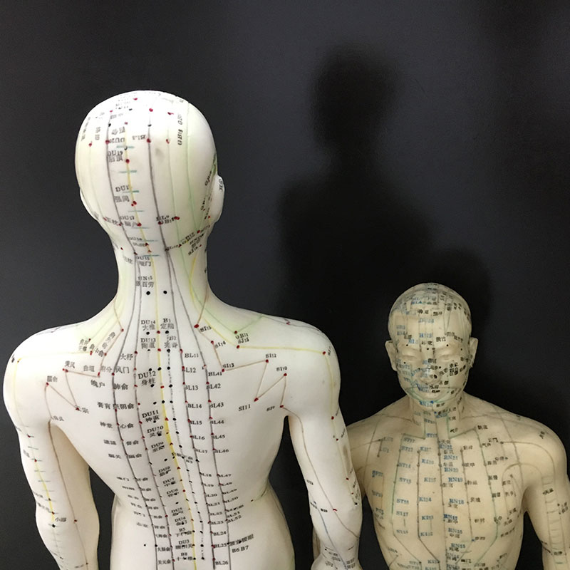 Acupuncture for workers' comp in Fresno, CA